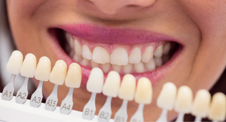 The Benefits of Kor Whitening
