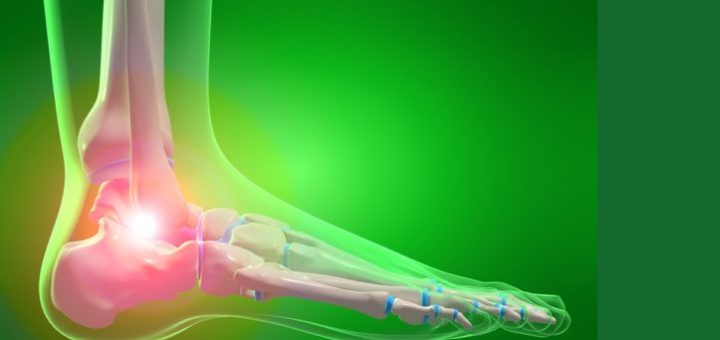 Heel Pain in Runners: Causes and Solutions