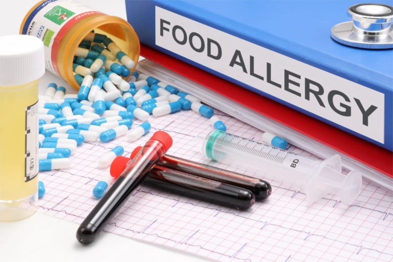 Understanding the Importance of Food Allergy Testing