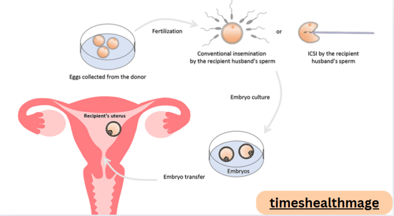 How to Find the Right Egg Donor and Understand the Process
