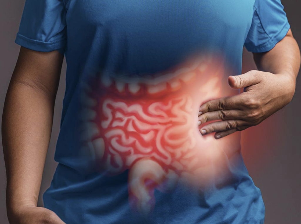 # Diagnostic Tests for Abdominal Pain