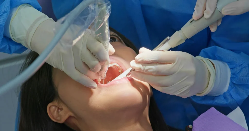How Long Do Dental Implants Really Last? A Deep Dive
