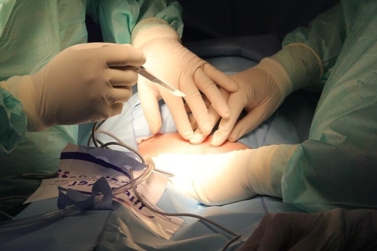 What To Expect During a Hemorrhoid Embolization Procedure