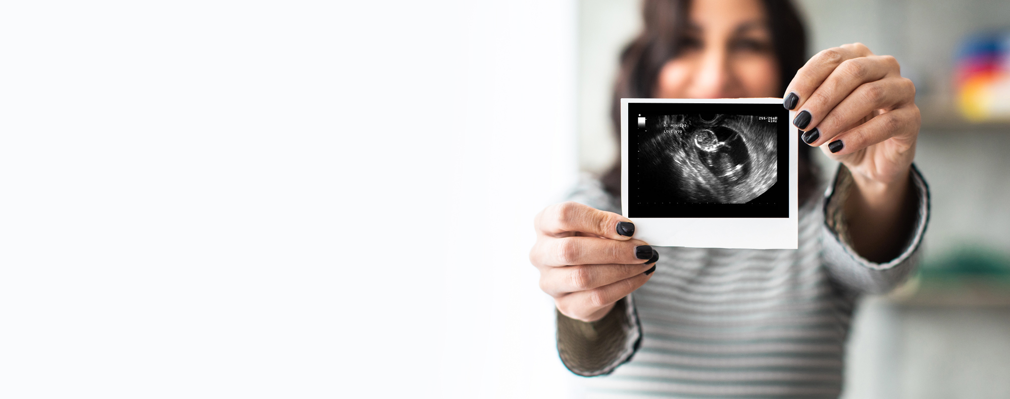 What To Expect at Your First Ultrasound
