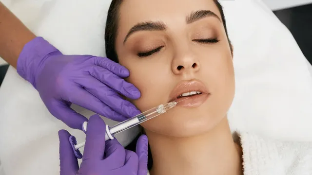What You Need to Know About Dermal Fillers