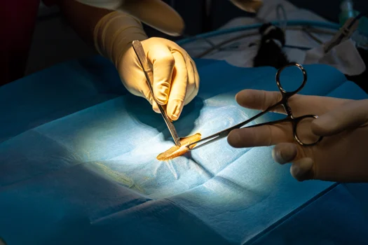 What to Expect During Recovery After Mohs Surgery