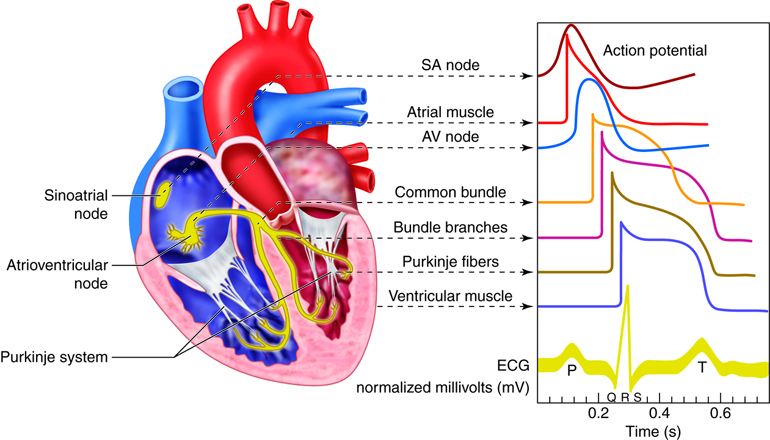 When Nuclear Stress Testing Becomes Essential for Diagnosing Heart Problems