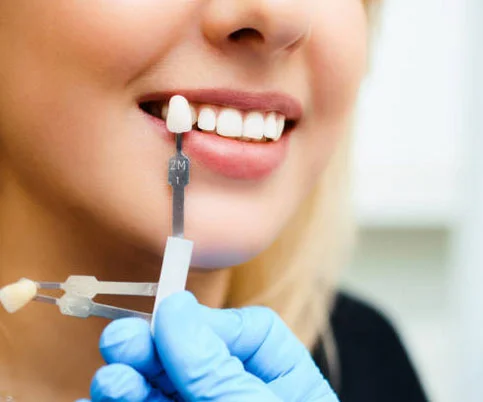 Why Dental Crowns Are Good Solutions for Cracked or Decayed Teeth
