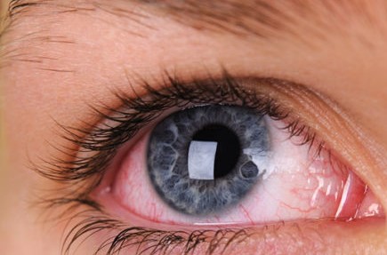 A Beginner's Guide to Managing Red Eyes After Long Workdays