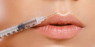 FAQs About How Botox Works