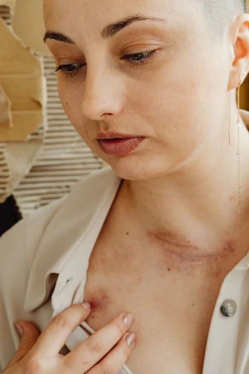 How to Manage Skin Cancer Scars and Heal Effectively