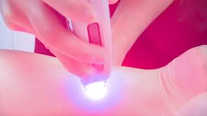 Myths vs. Facts About Laser Hair Removal