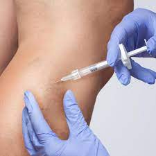 Treatments a Vein Specialist Offers