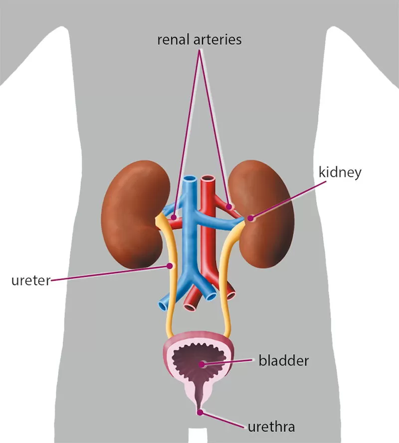 Signs and Symptoms of Kidney Stones