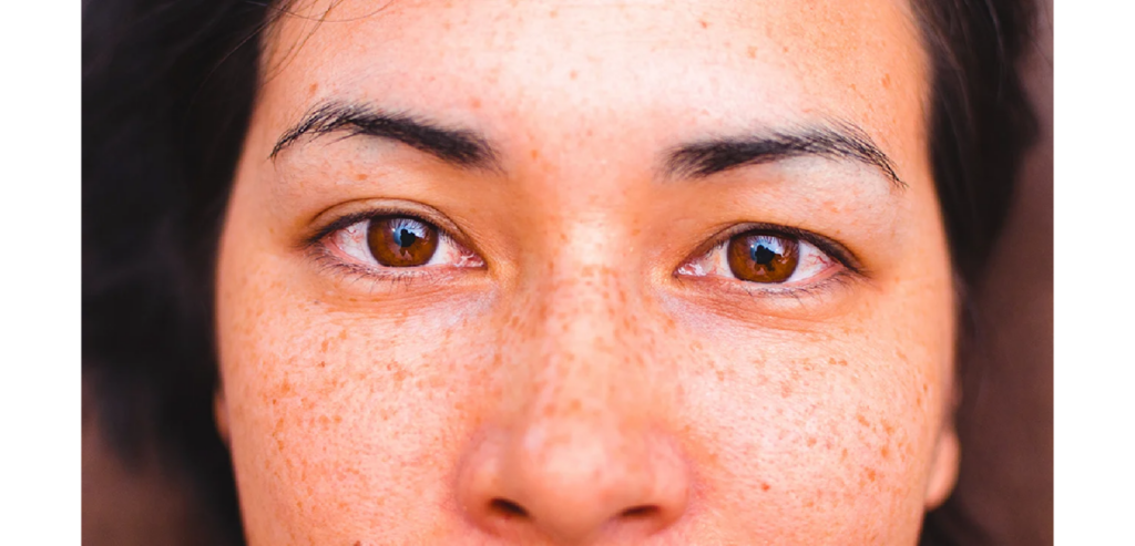 The Role of Dermatology in Managing Chronic Skin Conditions