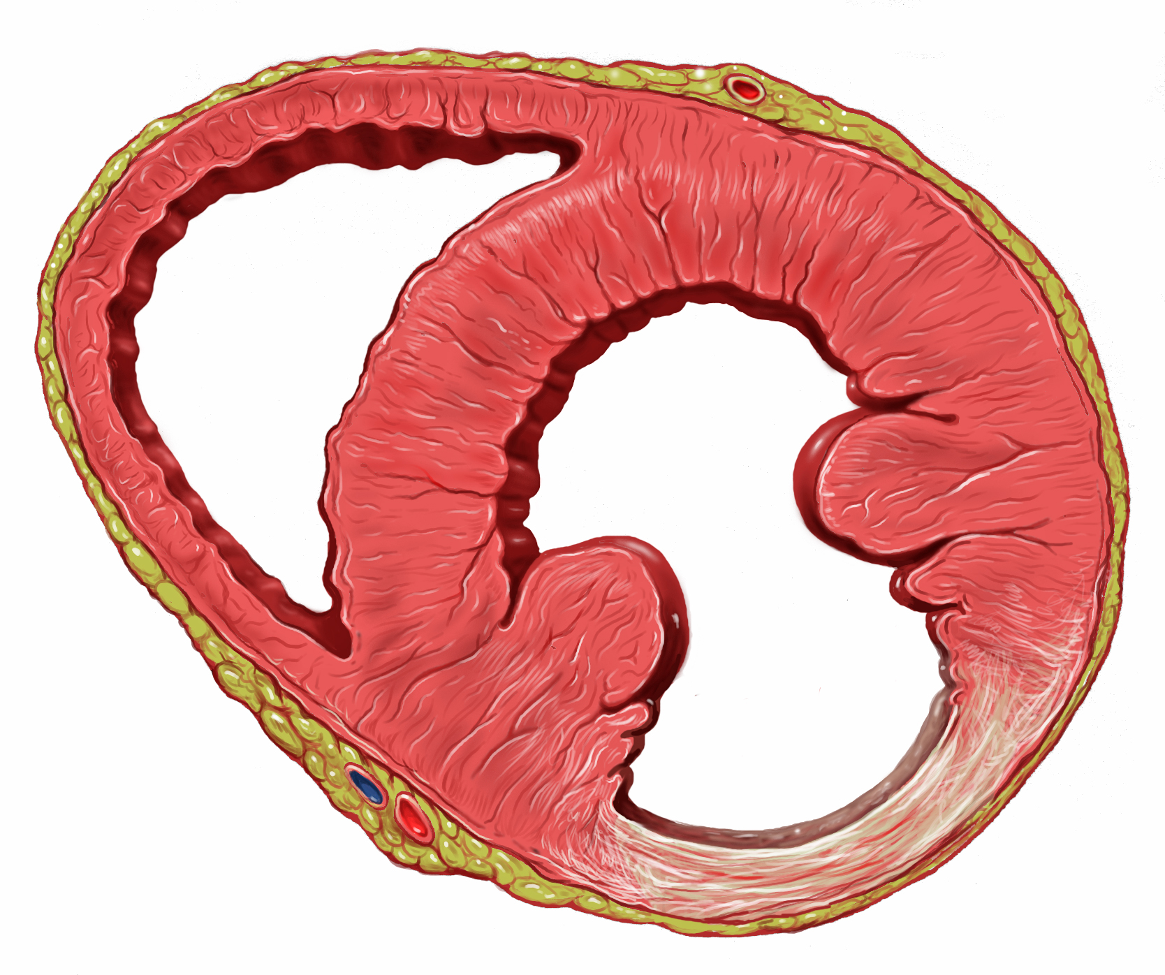 Understanding the Different Types of Heart Disease